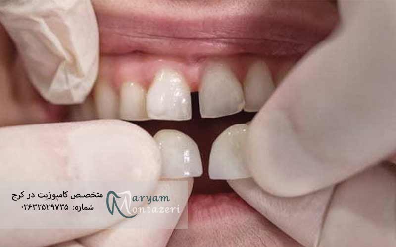 استفاده-طولانی‌مدت-بدون-مراجعه-به-دندانپزشک