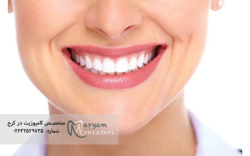 انواع-روش­های-انجام-بلیچینگ-دندان