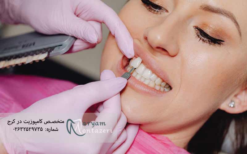 مراحل-انجام-ونیر-دندان-جلو