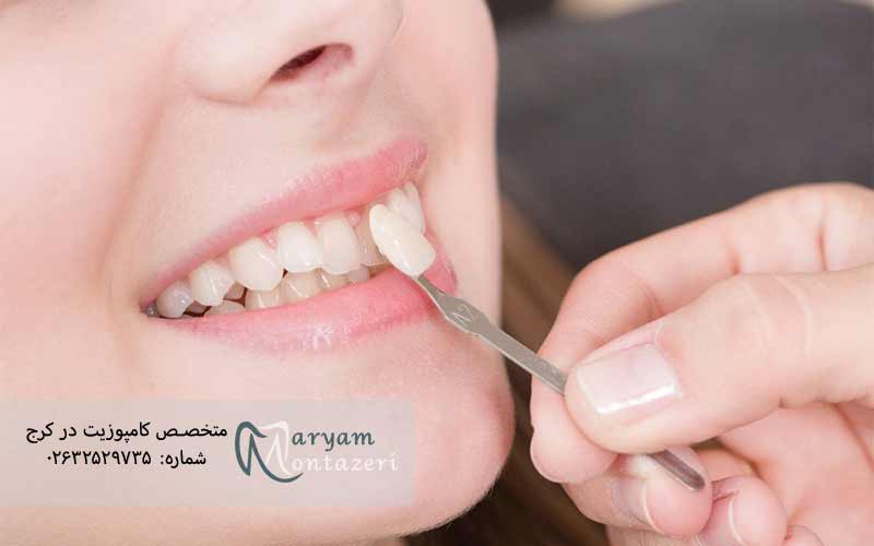 ونیر-دندان-جلو-چیست؟