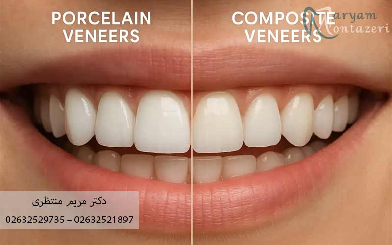 چرا-انتخاب-رنگ-کامپوزیت-مهم-است؟