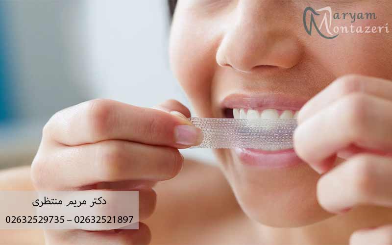 چرا-دندان‌ها-تغییر-رنگ-می‌دهند؟