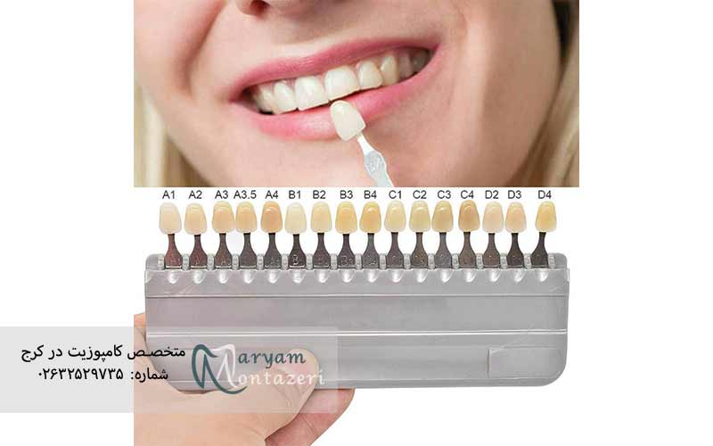 رنگ-دندان-a3