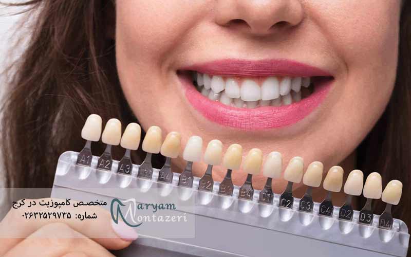 رنگ-روکش-دندان-a3