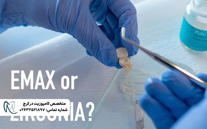 تفاوت لمینت Emax و زیرکونیا