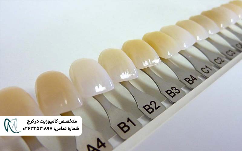 انتخاب رنگی طبیعی لمینت دندان