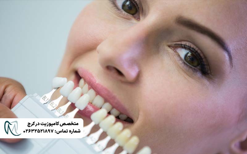 انتخاب رنگی طبیعی لمینت دندان
