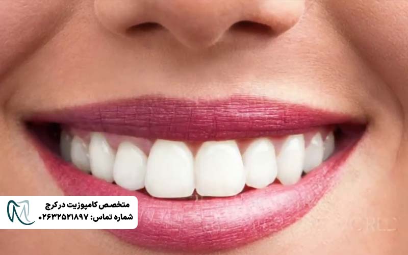 انواع طرح لبخند دندان