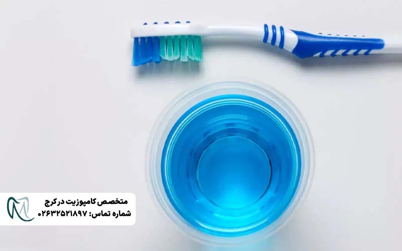 دهانشویه مناسب کامپوزیت و لمینت