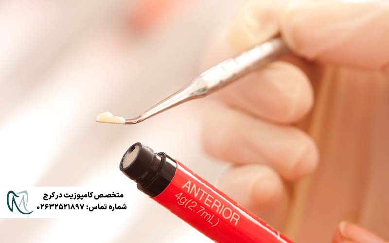 انواع کامپوزیت فورما