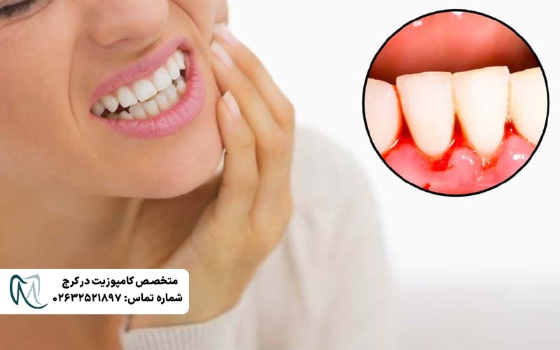 چرا لثه خونریزی می‌کند