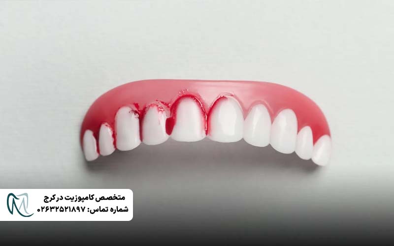 چرا لثه خونریزی می‌کند