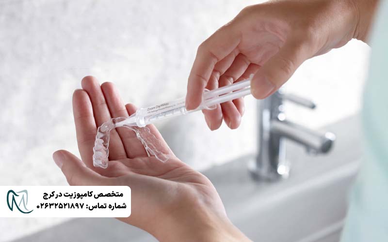 سفید کردن دندان در خانه