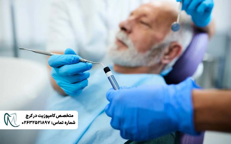 کامپوزیت توکویاما یا سارمکو