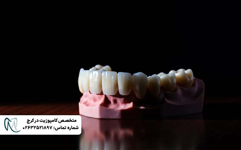 تفاوت روکش زیرکونیا و PFM